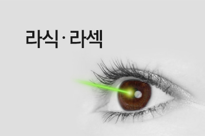 라식, 라섹